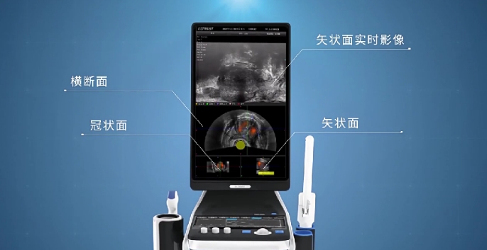 前列腺手術(shù)醫(yī)療設(shè)備產(chǎn)品三維動畫視頻